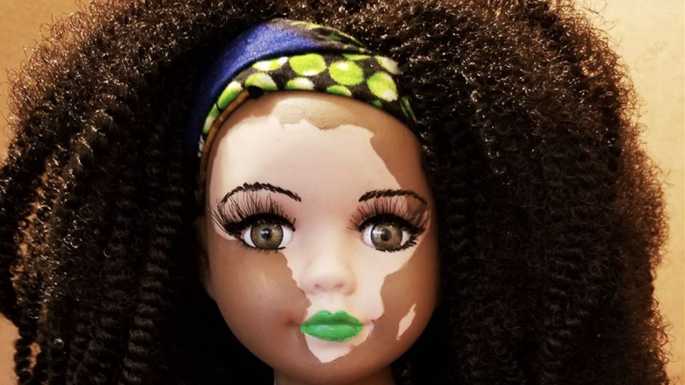 kay-customz-vitiligo-poupee